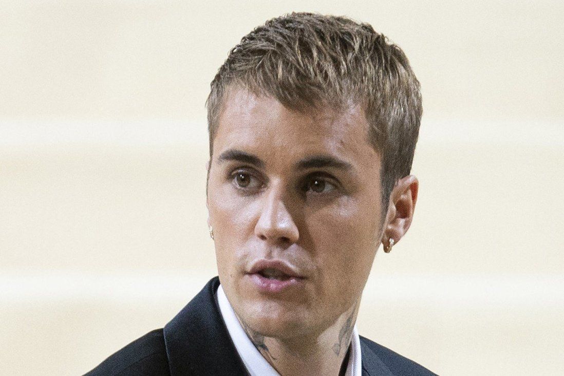 Justin Bieber says he is suffering from facial paralysis